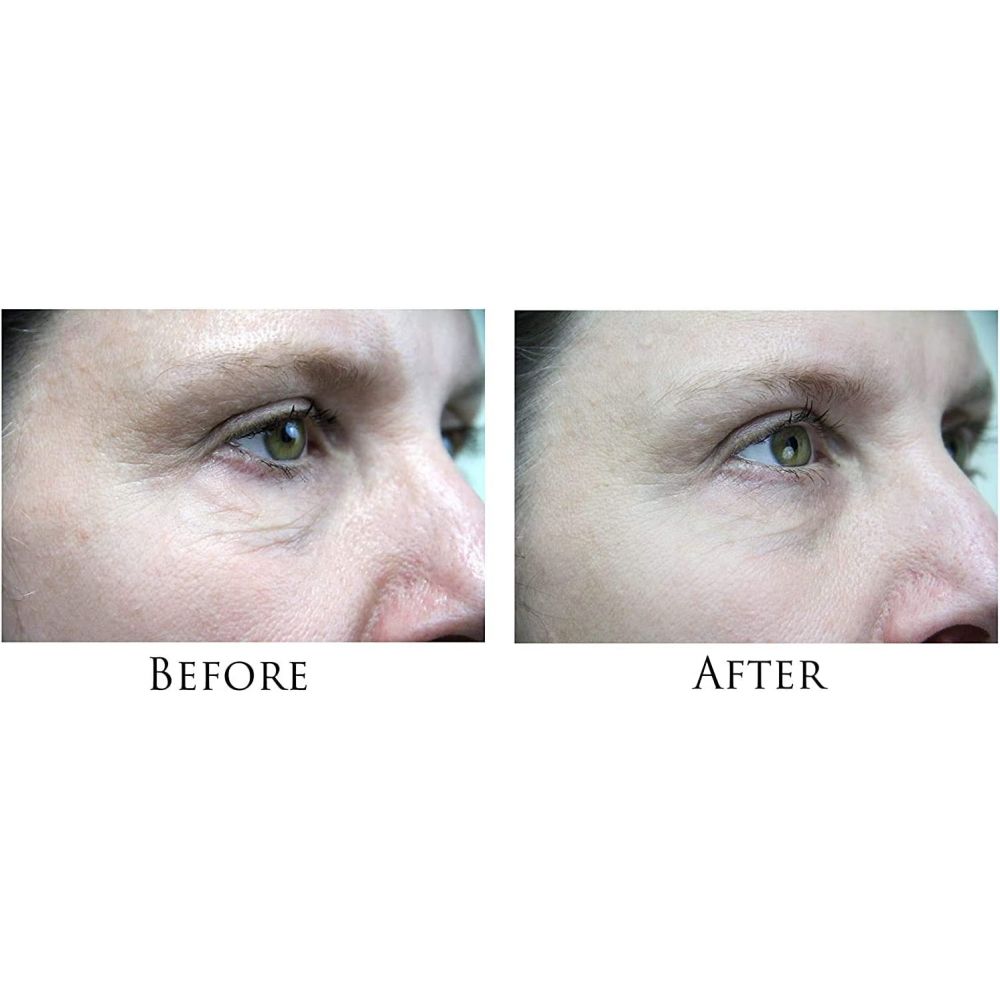 Wrinkle Reduction Facial Toning and Anti-Agin Microcurrent Machine